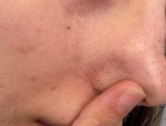 Customer photo review of Peel Shot Glow Black Rice Ampoule