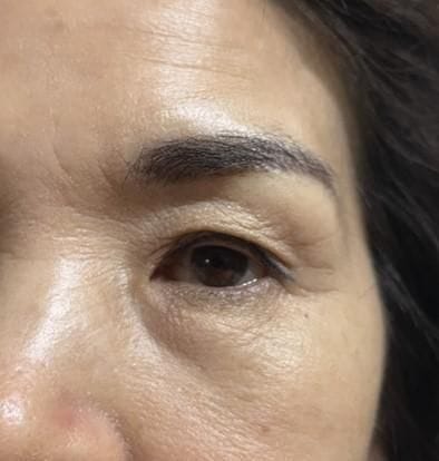 Customer photo review of Cemenrete Eye care Line