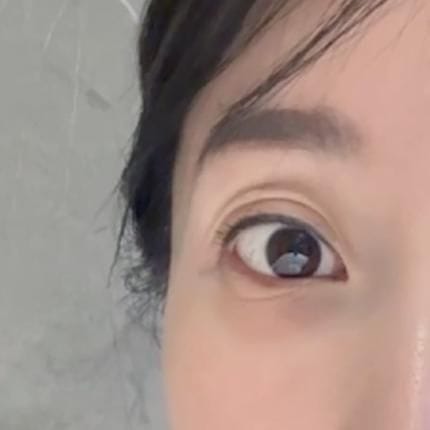 Customer photo review of EX Derma Booster Sonic Shot