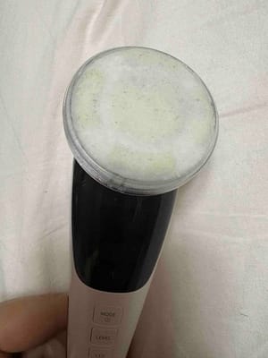Customer photo review of EXLUVIAN SkinPro 5