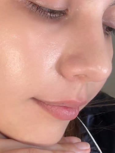 Customer photo review of Peel Shot Glow Black Rice Ampoule