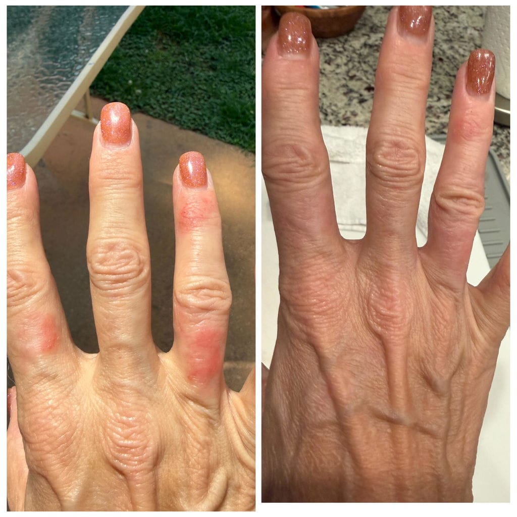 Customer photo review of Tallow & Honey Balm - 2 oz