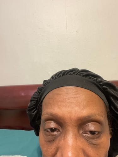 Customer photo review of TX Retinalsome Double Effect Eyecream