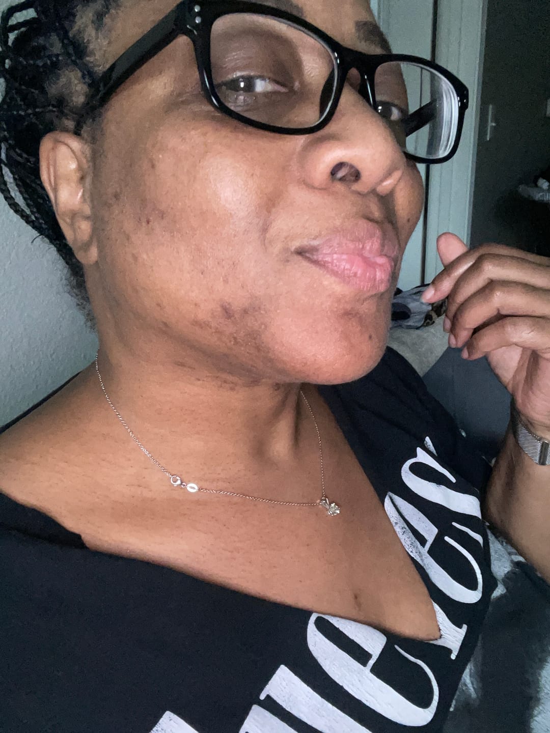 Customer photo review of PCOS RELIEF