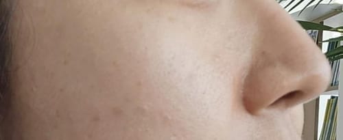 Customer photo review of Cemenrete Eye care Line
