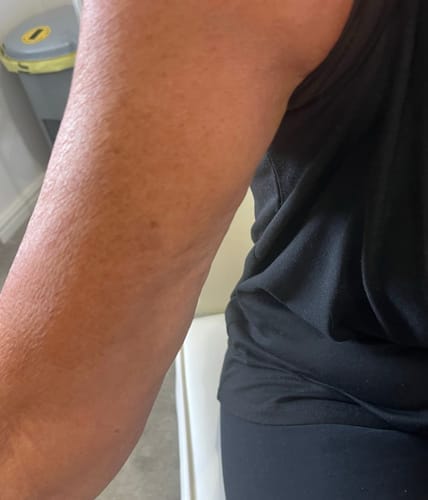 Customer photo review of Botanical Body Oil™