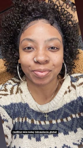 Customer photo review of Peel Shot Glow Black Rice Ampoule