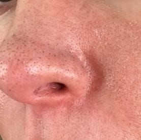 Customer photo review of Peel Shot Glow Black Rice Ampoule