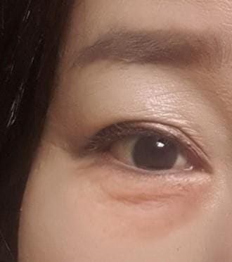 Customer photo review of Cemenrete Eye care Line