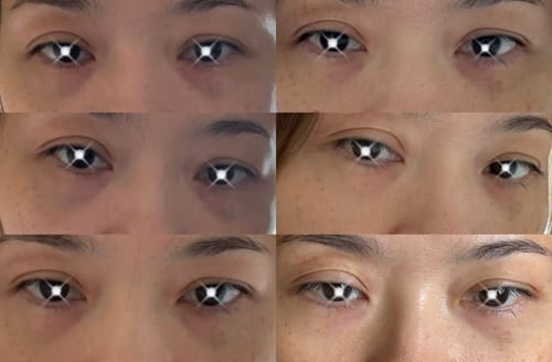 Customer photo review of Eyephalt Eyebag Cream