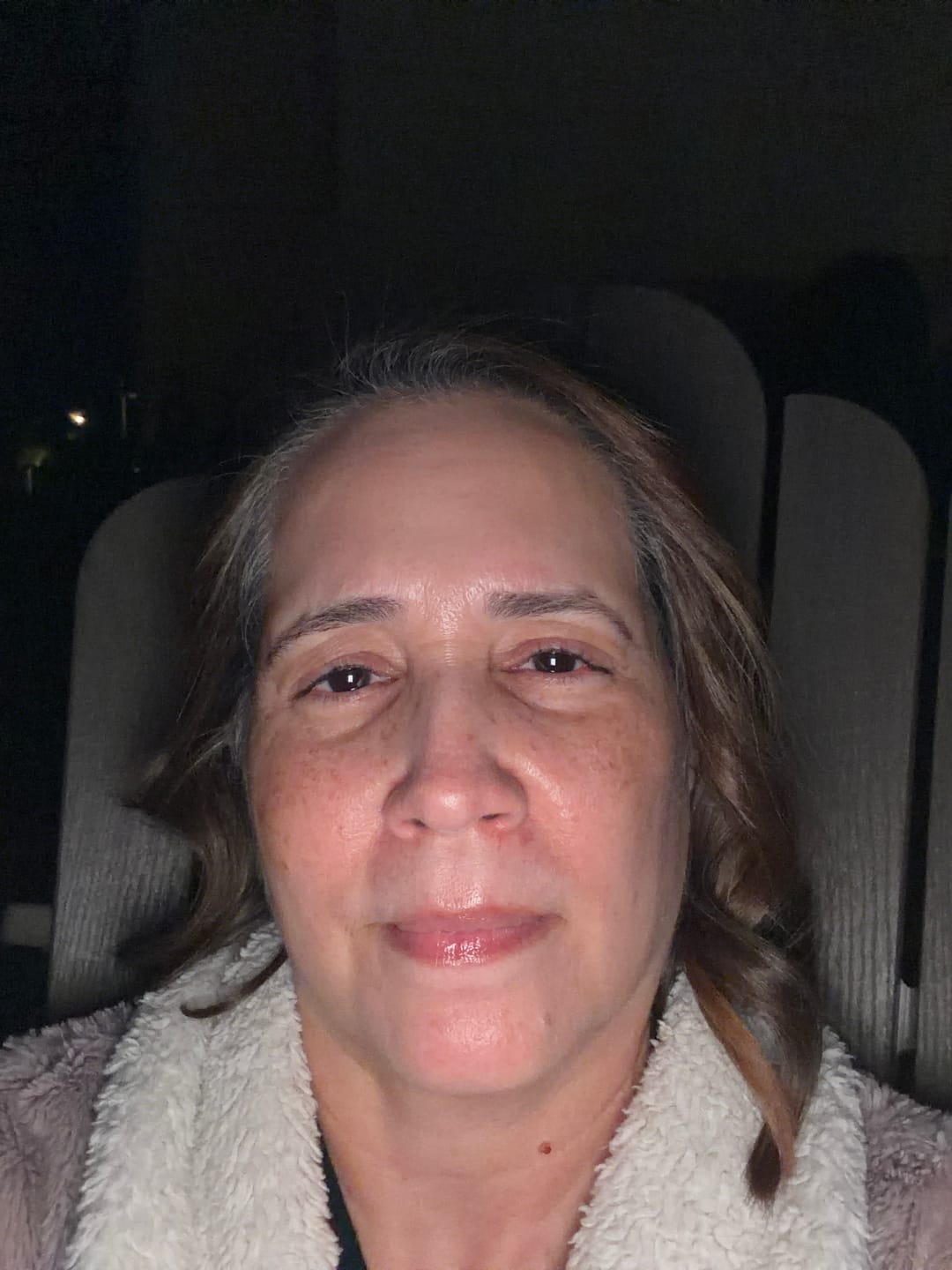 Customer photo review of ACTIVE PRO SERUM | ANTI-AGING