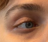 Customer photo review of TX Retinalsome Double Effect Eyecream