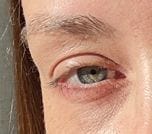 Customer photo review of TX Retinalsome Double Effect Eyecream