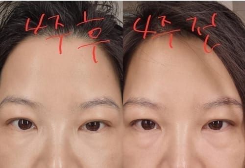 Customer photo review of Cemenrete Eye care Line