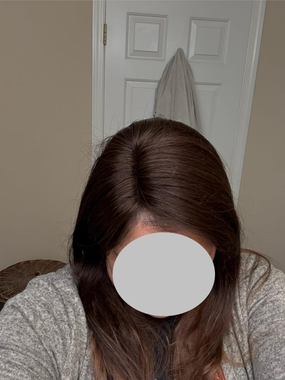 Customer photo review of [Virgin Hair] Hair Toppers for Thinning Hair Medium Brown Hairpiece #4