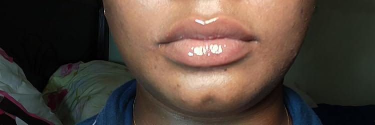 Customer photo review of LipDew™ Hydrating Oil