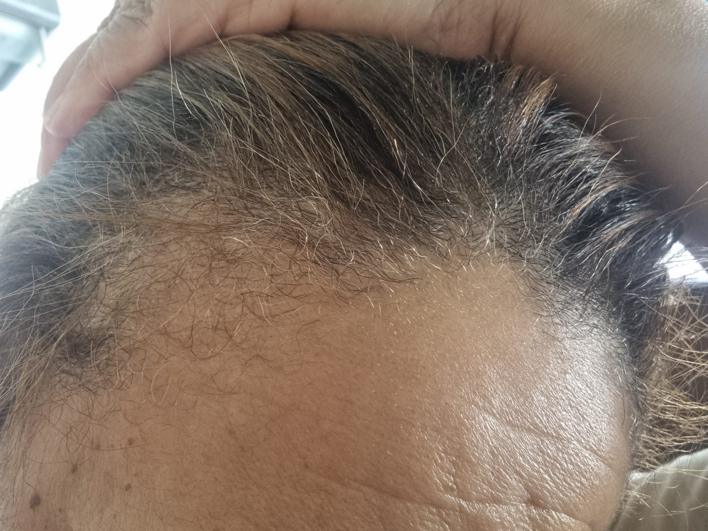 Customer photo review of Hair & Nail Capsules