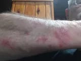 Customer photo review of Crema natural MANÚ™ Anti Eczema 100g
