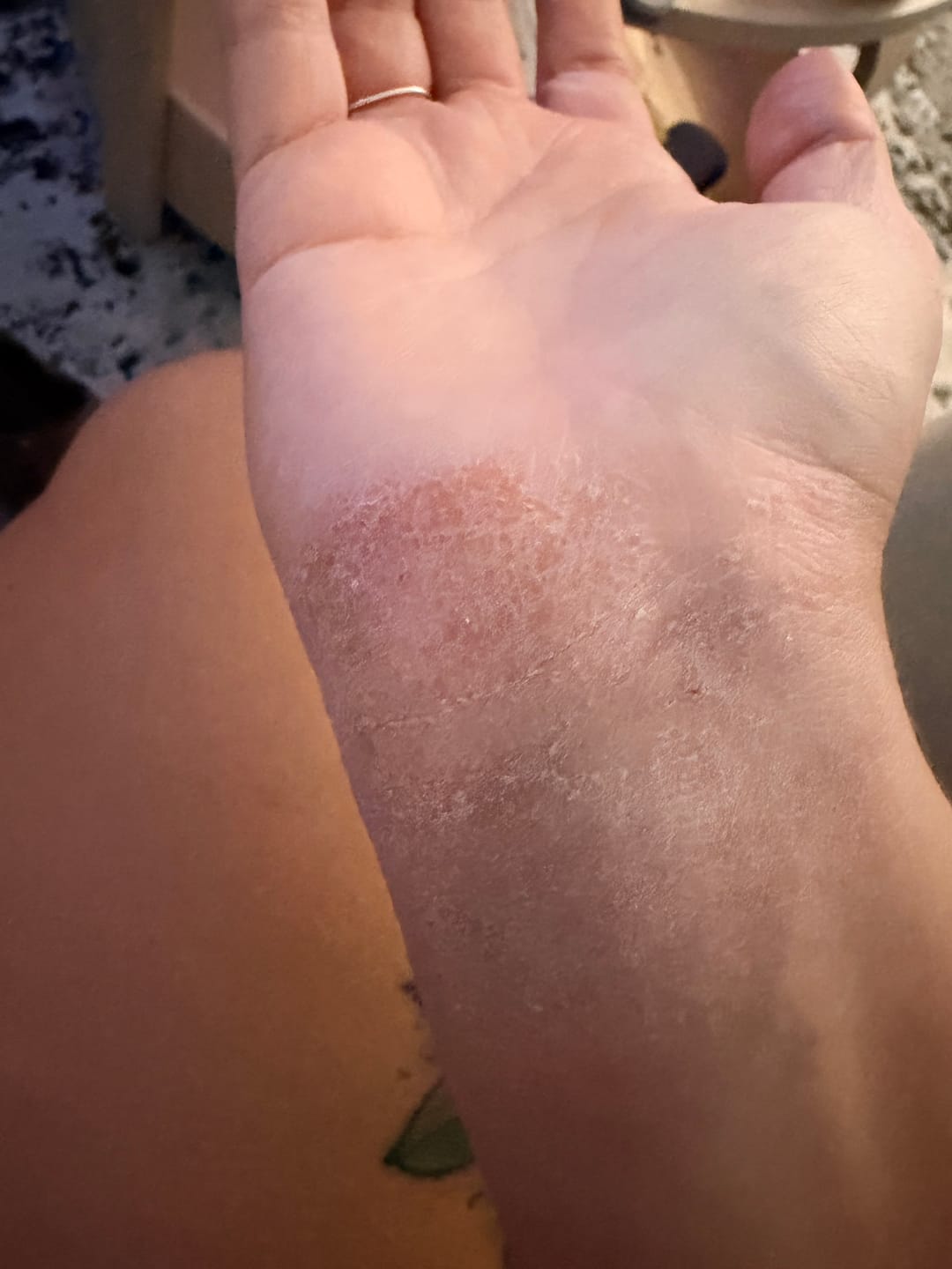 Customer photo review of Seb Natural Soothing Balm