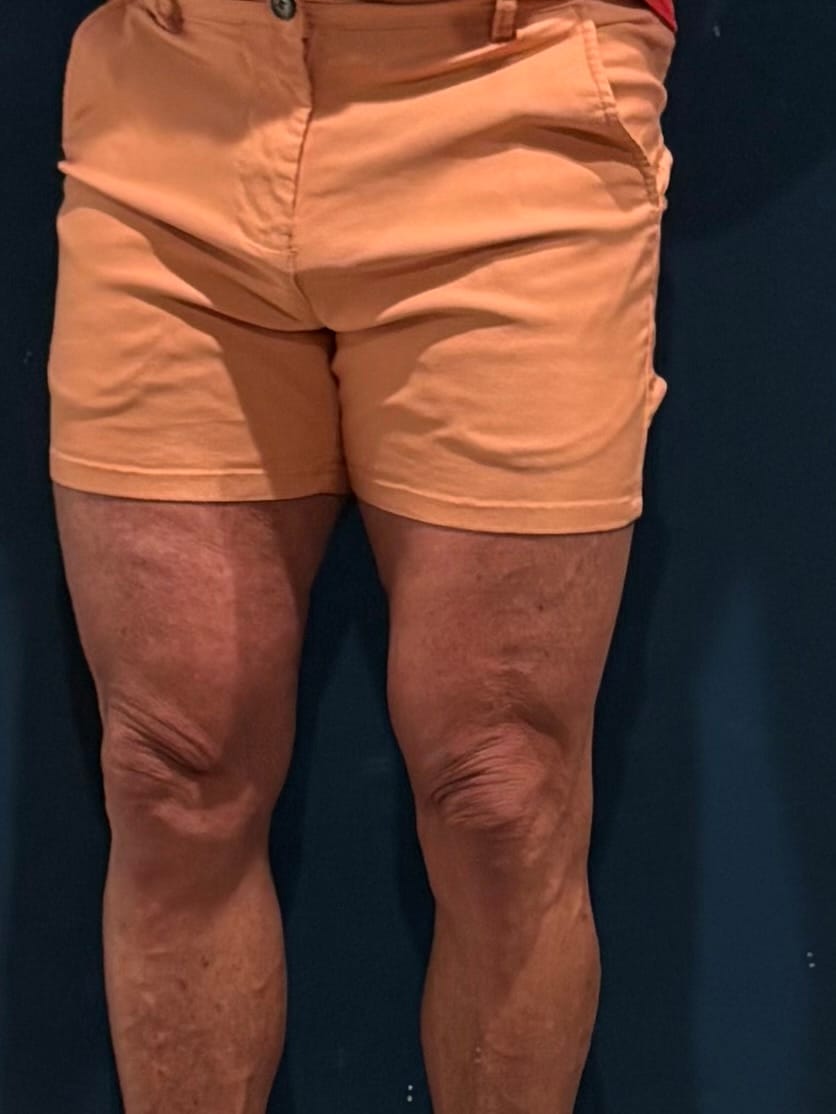 Customer photo review of Ultra-Stretch 5" Chino Shorts - Teal