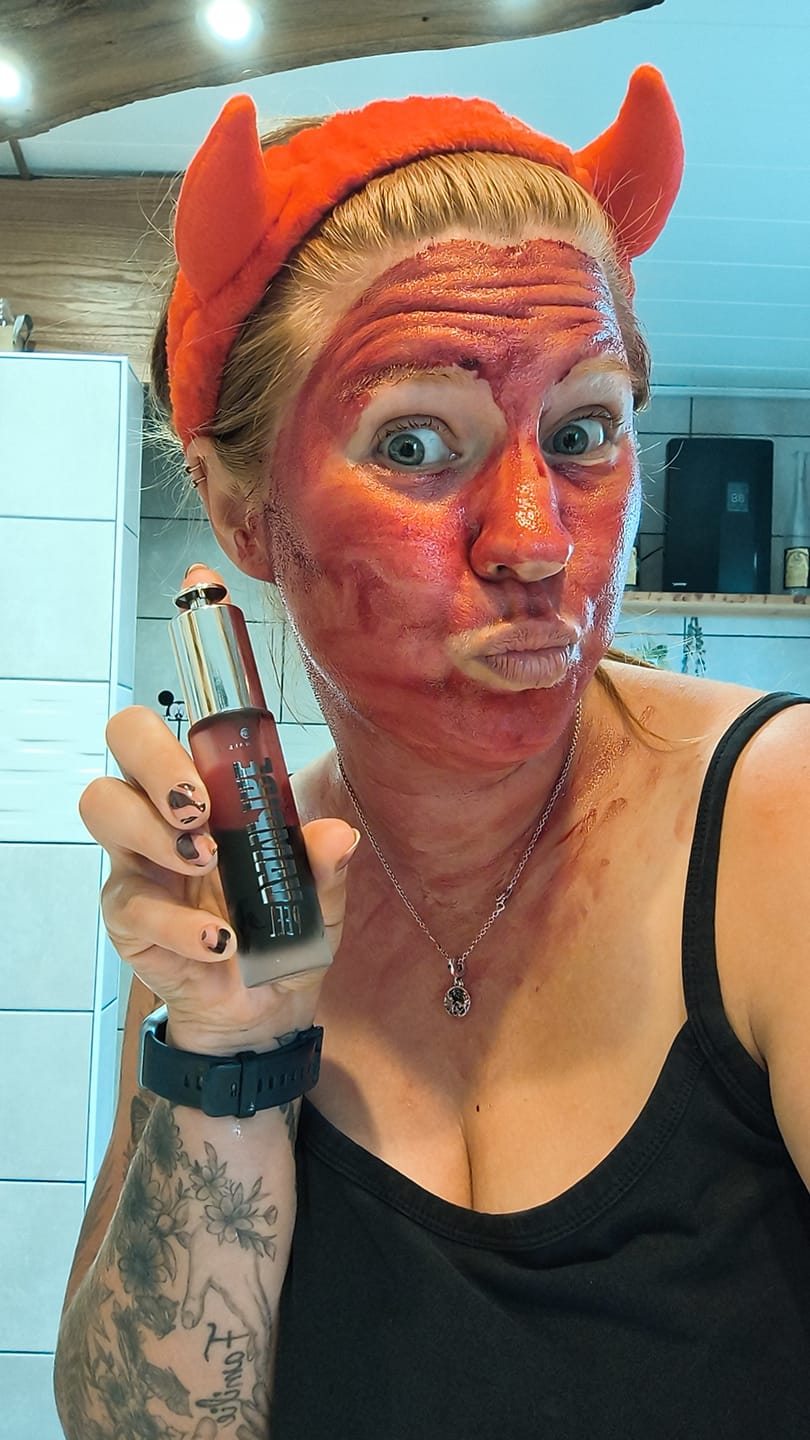 Customer photo review of VAMPIRE PEEL® - Fruchtsäurepeeling