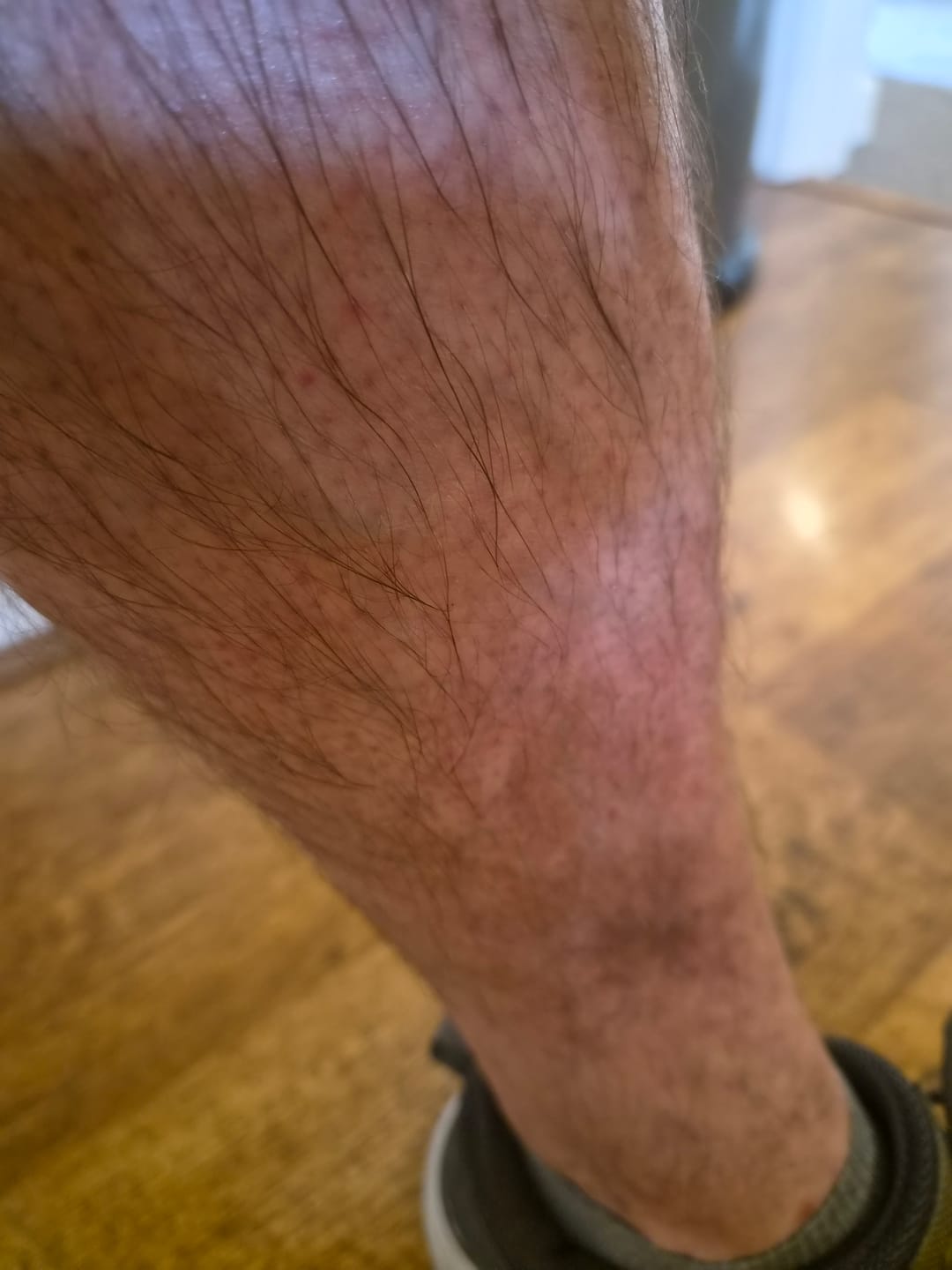 Customer photo review of Whipped Grass-Fed Tallow Face Cream | With Sweet Almond Oil