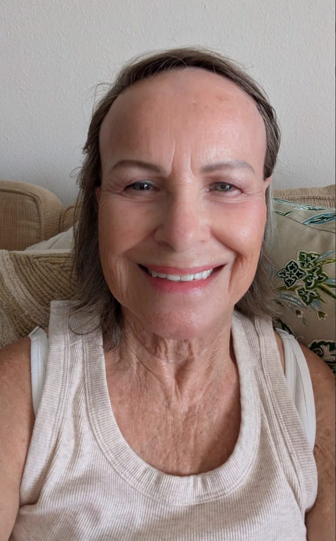 Customer photo review of Gleama™ Baume au Suif & Miel