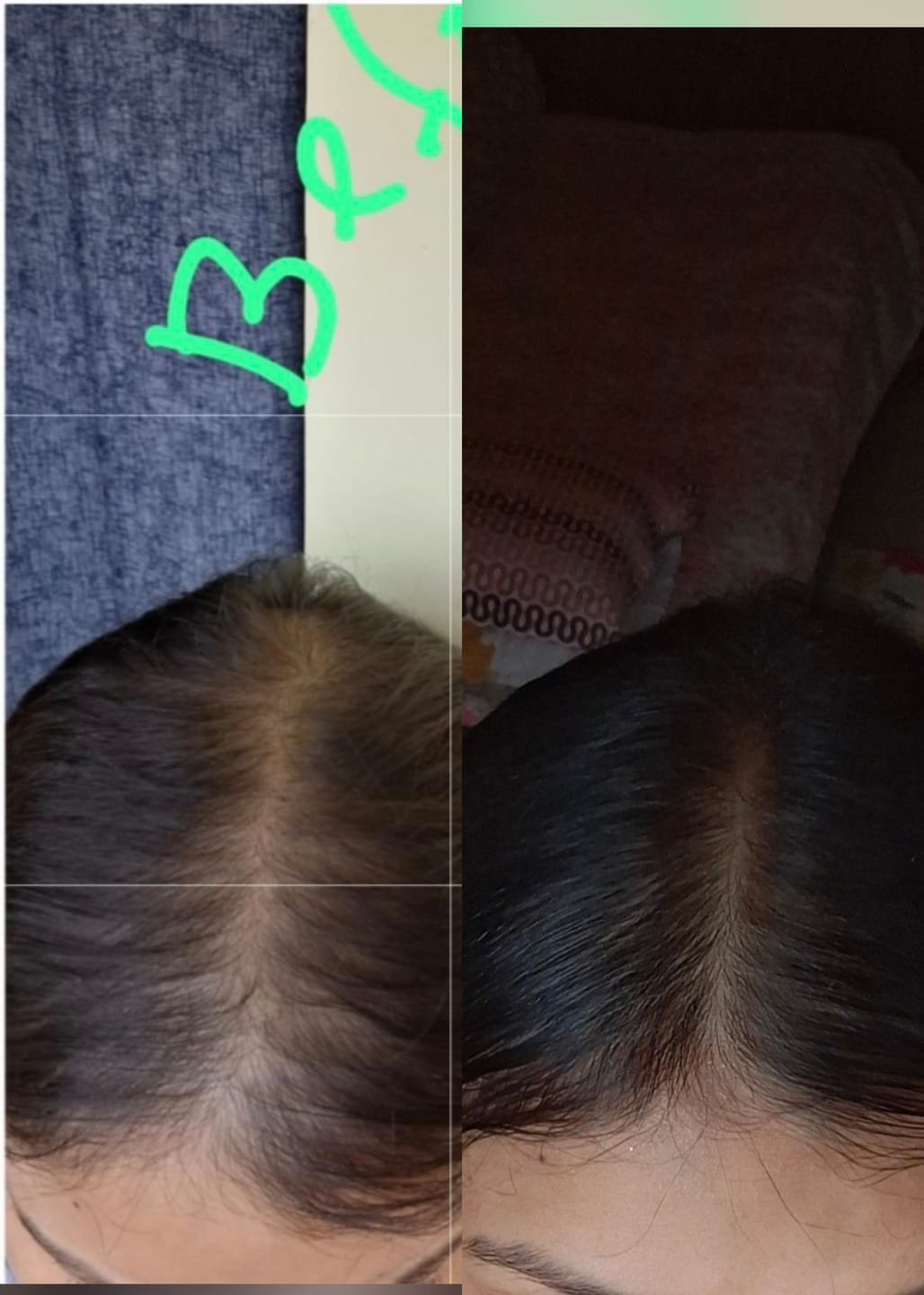 Customer photo review of VITAFOAM ™ Hair Growth Formula