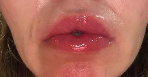 Customer photo review of LipDew™ Hydrating Oil