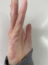 Customer photo review of Crema natural MANÚ™ Anti Eczema 100g