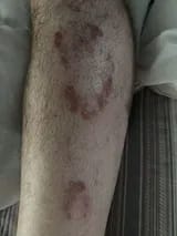 Customer photo review of Crema natural MANÚ™ Anti Eczema 100g