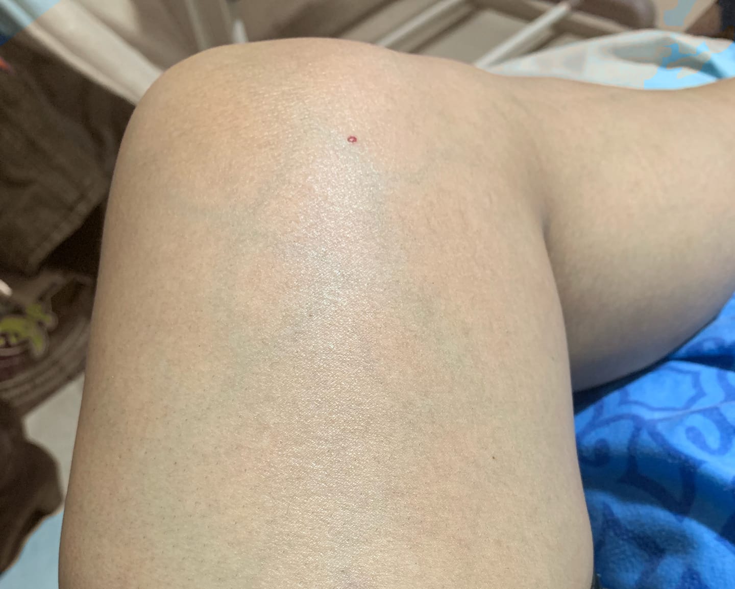 Customer photo review of Aceite Corporal Reafirmante - Combate Celulitis, Flacidez y Arrugas