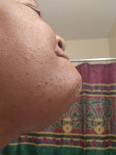Customer photo review of Authentic African Black Soap