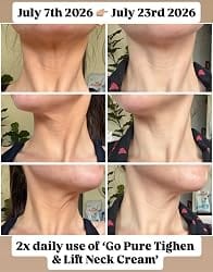 Customer photo review of CollaNeck™ Firming Care