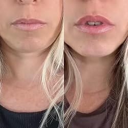 Customer photo review of LipDew™ Hydrating Oil