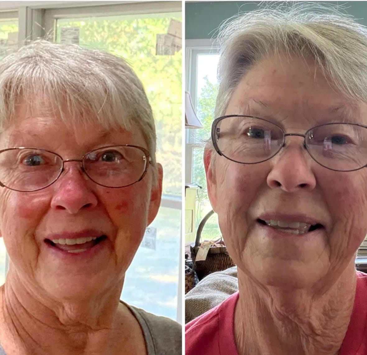 Customer photo review of Gleama™ Baume au Suif & Miel
