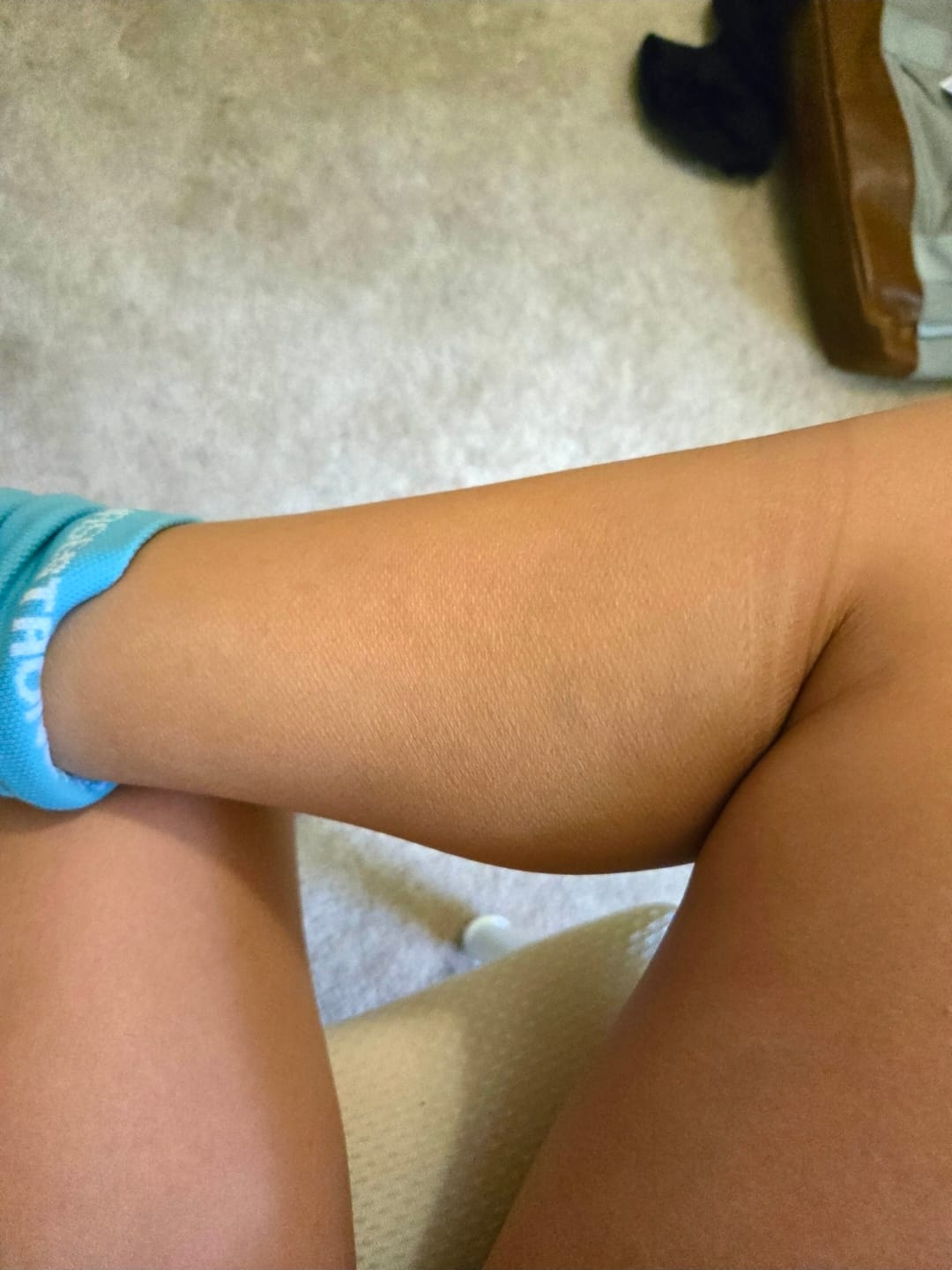 Customer photo review of NurseStrong Performance Compression Socks