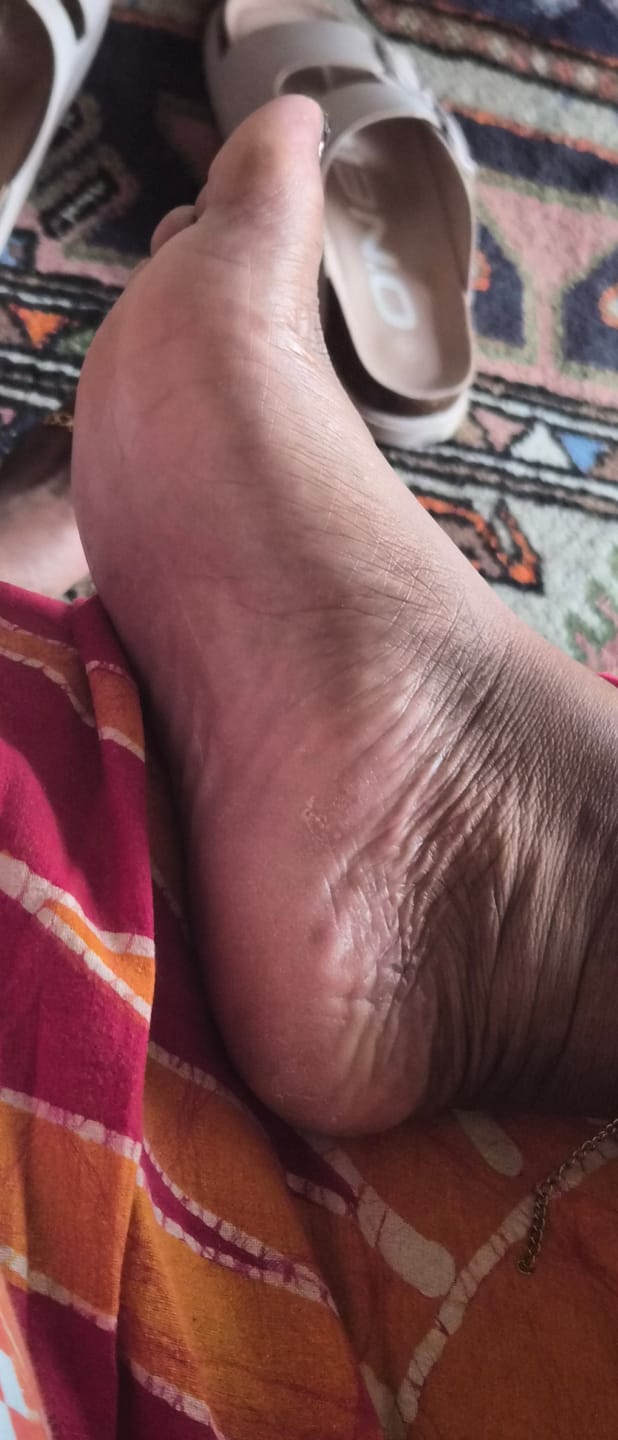 Customer photo review of ✨ HoneyGlow™ – Kit Beauté Pieds