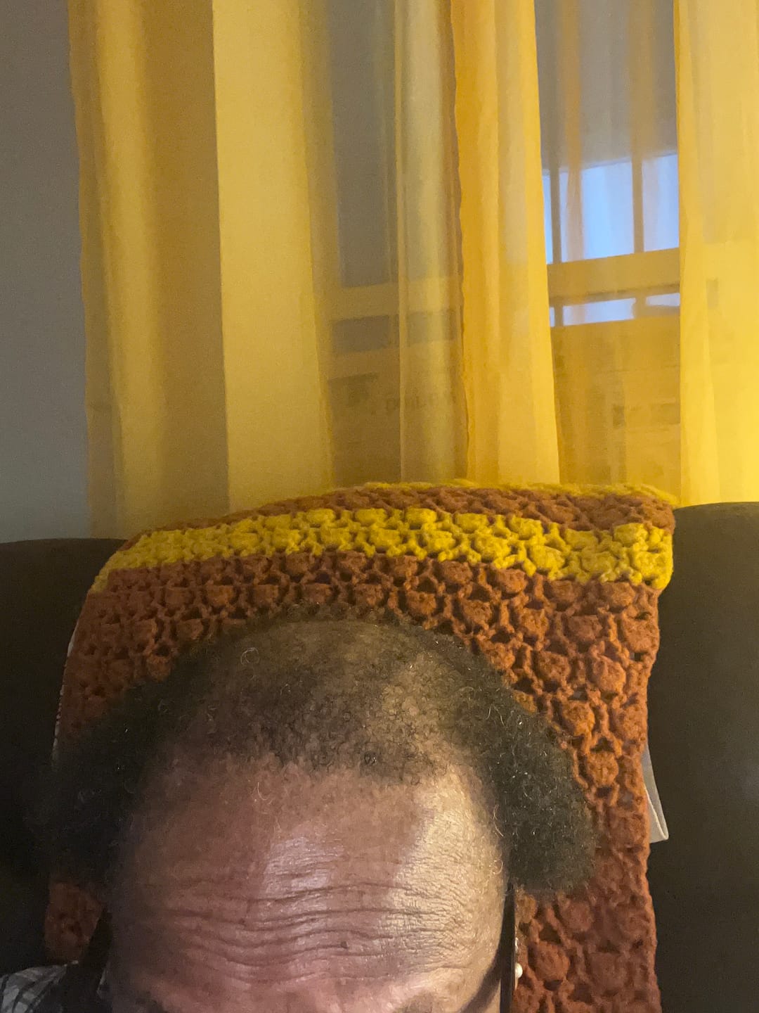 Customer photo review of Scalp Moisturizing Leave-In Treatment