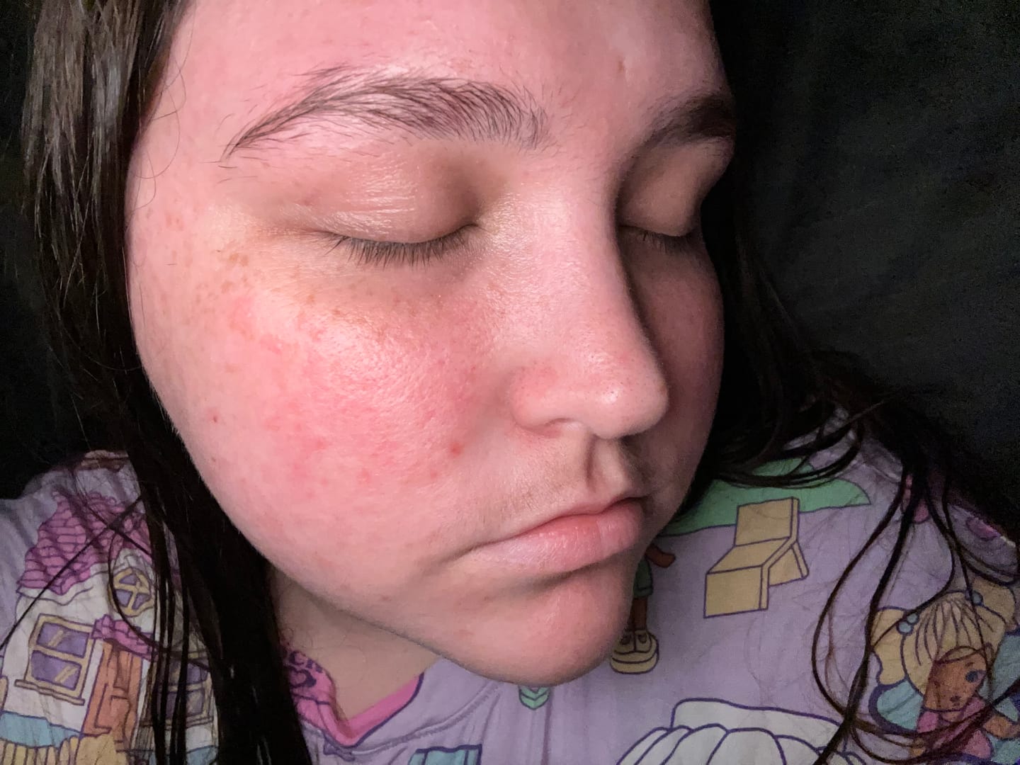 Customer photo review of Watermelon Nurturing Belly & Body Oil