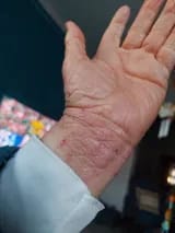 Customer photo review of Crema natural MANÚ™ Anti Eczema 100g