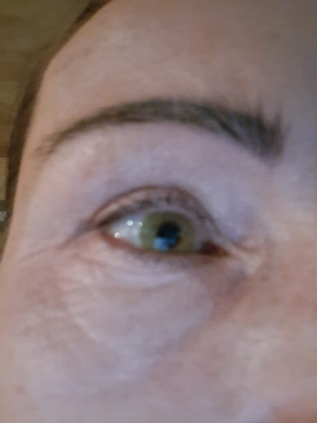 Customer photo review of Allure