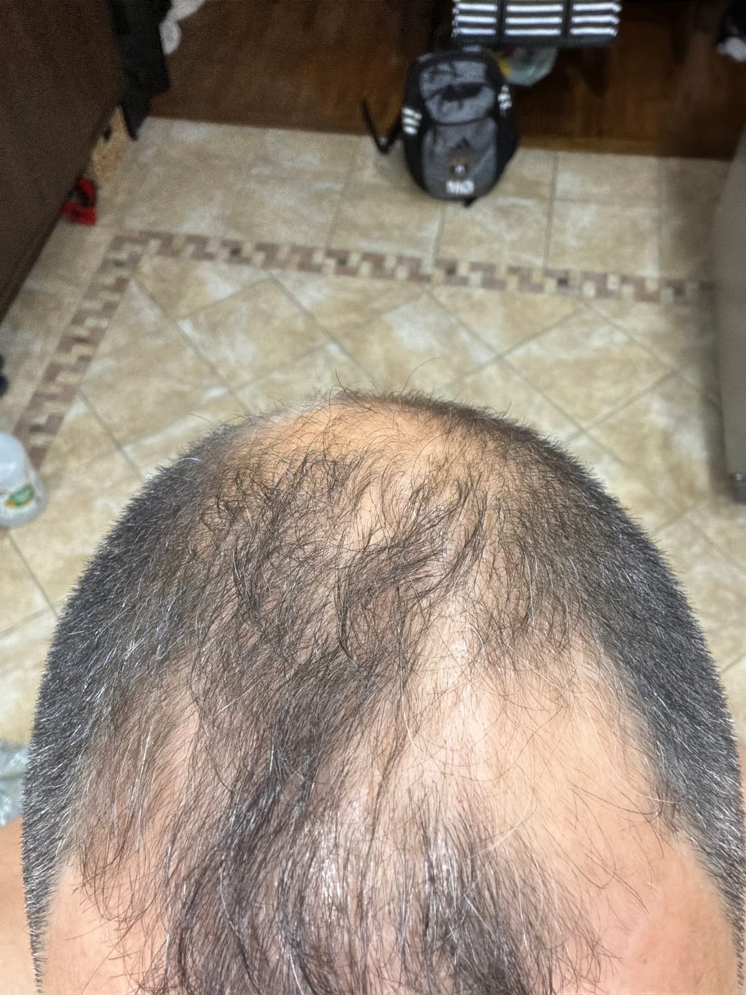 Customer photo review of Spartan™ Root Activator Shampoo 6 Bottles(sc)