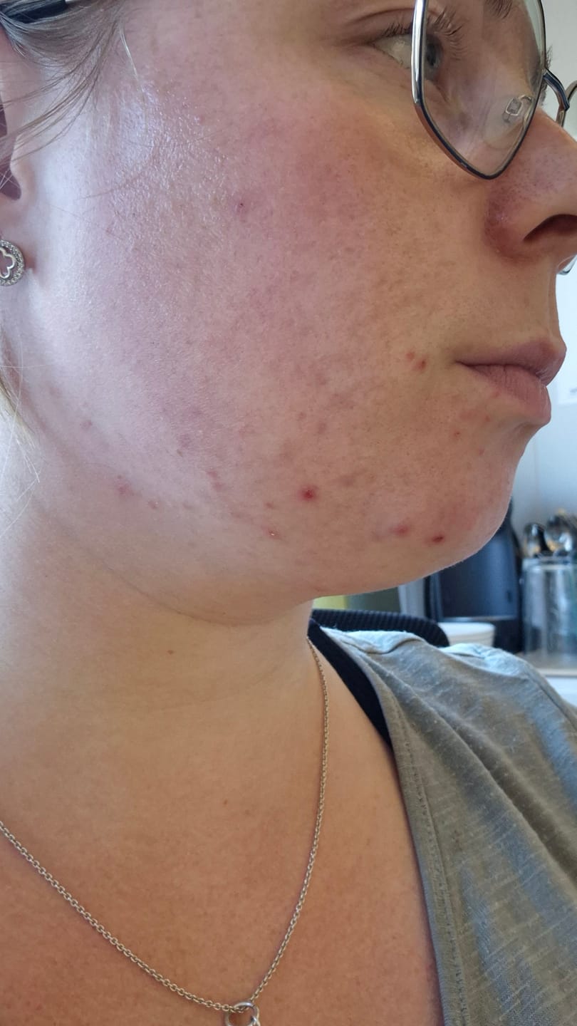 Customer photo review of The Potions Cica Smooth Peeling Pads (60stk) - Enkel eksfoliering som revitaliserer og fornyer