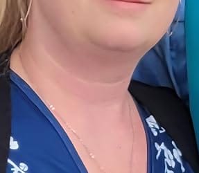Customer photo review of CollaNeck™ Firming Care