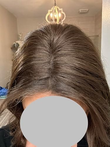 Customer photo review of [Virgin Hair] Hair Toppers for Thinning Hair Medium Brown Hairpiece #4