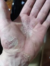 Customer photo review of Crema natural MANÚ™ Anti Eczema 100g