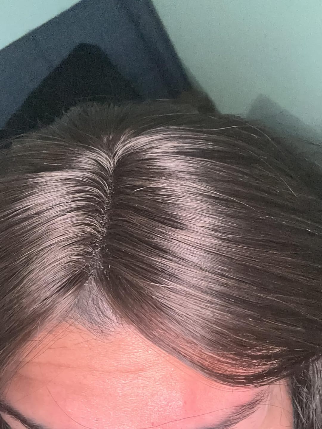 Customer photo review of [Virgin Hair] Full Cuticle Hair Topper Real Human Hair Dark Brown #2