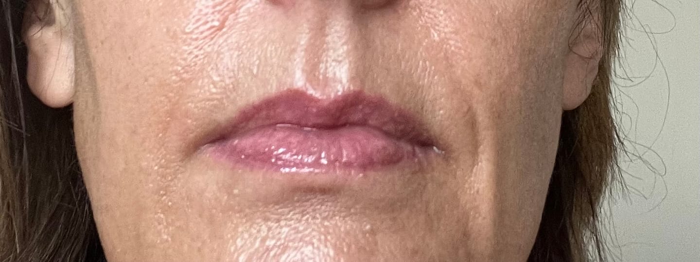 Customer photo review of Lip Serum