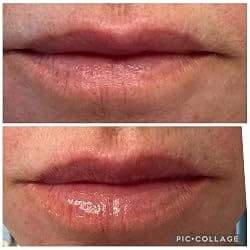 Customer photo review of LipDew™ Hydrating Oil
